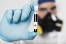 В Европе зафиксировали первый случай смерти от коронавируса