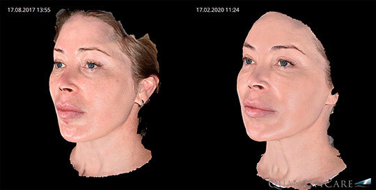 Когда «плывет» лицо, спасать его должны профессионалы