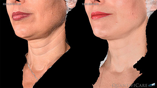 Когда «плывет» лицо, спасать его должны профессионалы