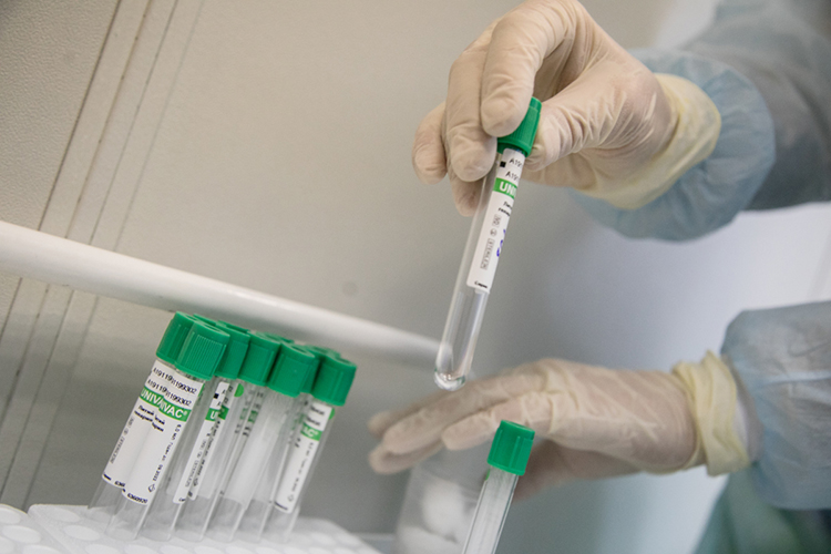 Тесты на антитела (иммуноглобулины) или, по другому, серологические исследования, нужны, чтобы понять, болеет или переболел ли человек коронавирусом