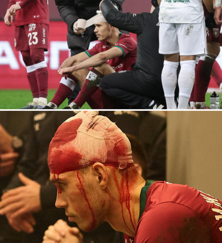 Константин Нижегородов разбил себе голову в матче с «Ахматом»