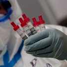 В России создали первый в мире быстрый тест для выявления гепатита С