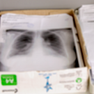 В России почти в 2 раза взлетела заболеваемость пневмонией