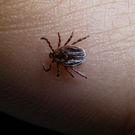 В минздраве прогнозируют рост популяции клещей, Татарстан – в числе регионов риска